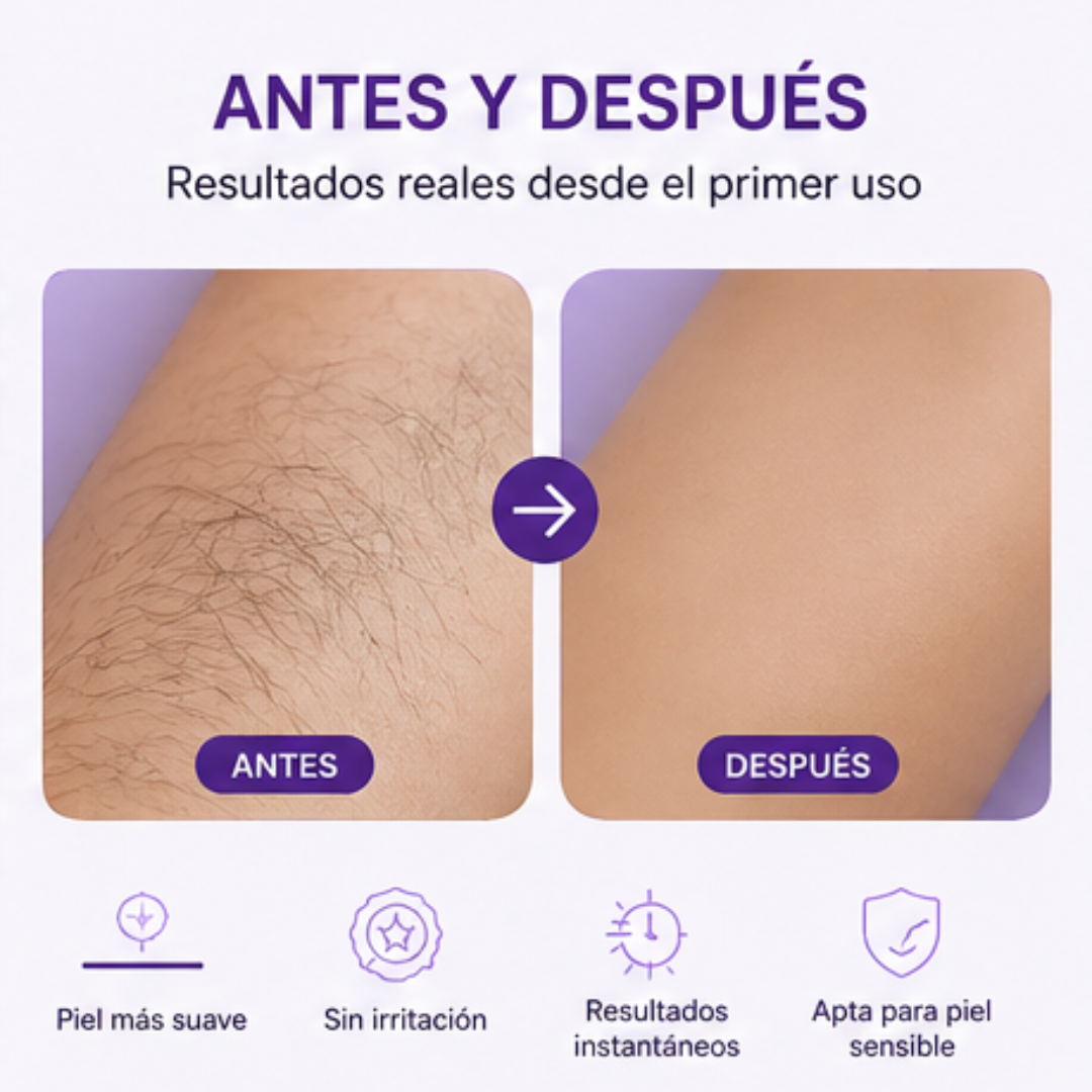 Depiladora Flash - Depilación sin dolor