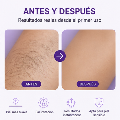 Depiladora Flash - Depilación sin dolor